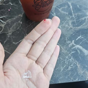 Kahvede Cam Parçalarıyla Karşılaştık, Çalışanlar Önlem Almadı