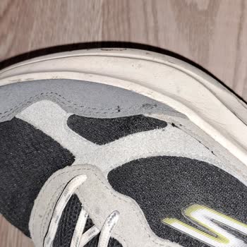 Skechers Ayakkabım Üç Ayda Yıprandı, Çözüm Sunulmadı!