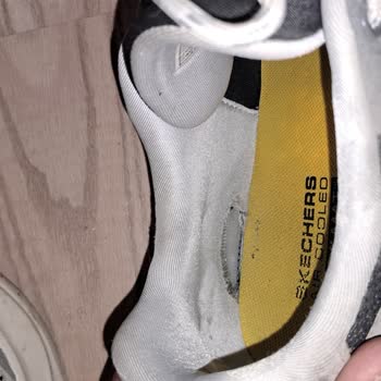 Skechers Ayakkabım Üç Ayda Yıprandı, Çözüm Sunulmadı!