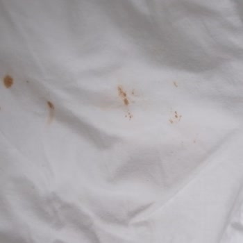 Pas Sorunu Çözülemiyor, Servis Ve Merkez Tutarsız