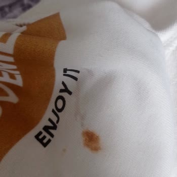 Pas Sorunu Çözülemiyor, Servis Ve Merkez Tutarsız