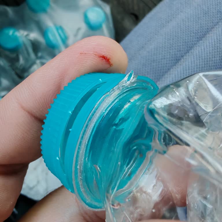 Pet Şişe Kapaklarındaki Çapaklar Yaralanmaya Sebep Oluyor