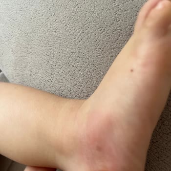 Sinek Kovucu Sprey Etkisiz Kaldı Endişeliyim