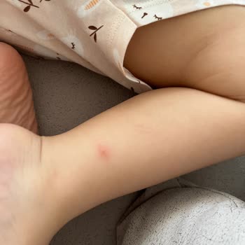 Sinek Kovucu Sprey Etkisiz Kaldı Endişeliyim