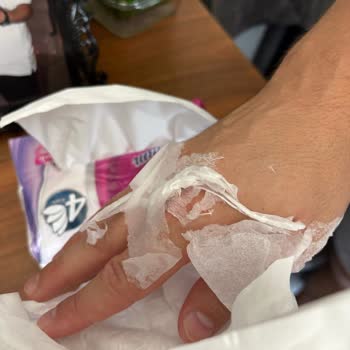 Islak Mendil Dayanıklılığı Hakkında Şikayet