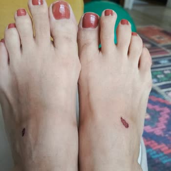 Aldığım Terlik Ayağımı Yaraladı, İade Talebim Reddedildi