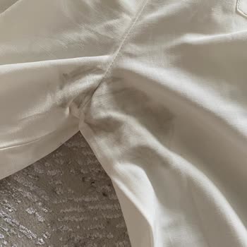 Leke Şoku: Trendyol Ve Satıcı Müşteriyi Suçladı!