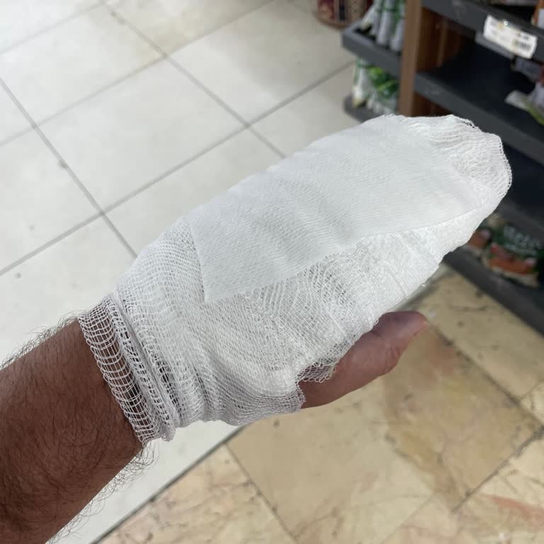 YHT Kafeteryasında Sıcak Çay Kazası: Güvenlik Önlemleri Yetersiz