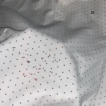 Bosch Çamaşır Makinesi Kıyafetlerimi Yırtıyor, Servis Sorunu Kabul Etmiyor