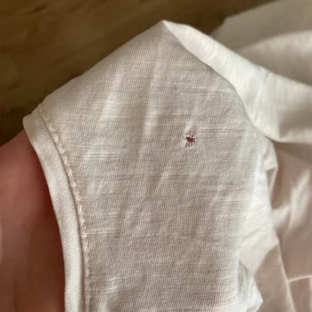 Bosch Çamaşır Makinesi Kıyafetlerimi Yırtıyor, Servis Sorunu Kabul Etmiyor