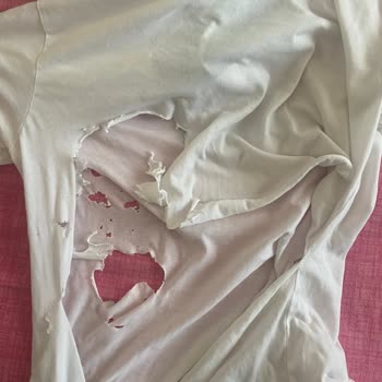 Mavi Tişört Kısa Sürede Yırtıldı, Destek Bekliyorum