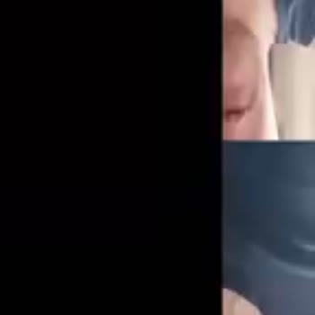 Yeni Alınan Telefonda Kamera Sorunu