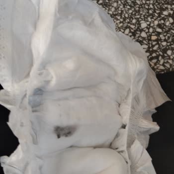 Aldığım Bebek Bezinde Küf Benzeri Leke Çıktı