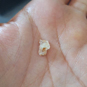 UNO Ekmekten Çıkan Yabancı Madde Dişimi Çatlattı, Firma Sorumluluk Almadı