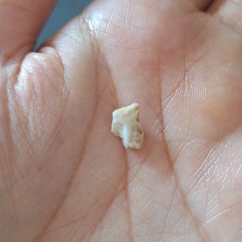 UNO Ekmekten Çıkan Yabancı Madde Dişimi Çatlattı, Firma Sorumluluk Almadı