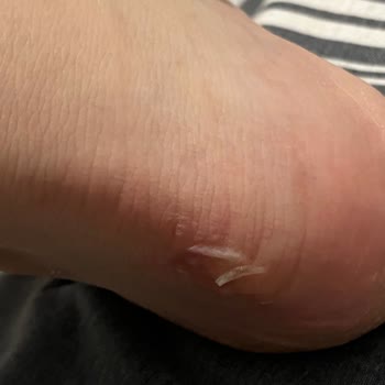 Kısa Sürede Deforme Olan Ayakkabı İçin Değişim Talebim Reddedildi