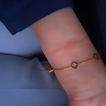 Bozuk Bardaklık Nedeniyle Yanma Ve İlgisiz Muavin Davranışı