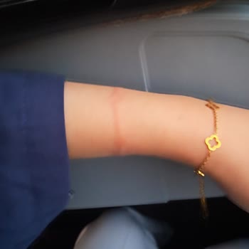 Bozuk Bardaklık Nedeniyle Yanma Ve İlgisiz Muavin Davranışı