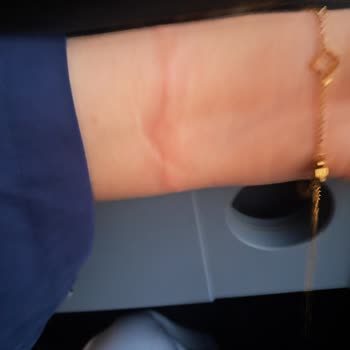 Bozuk Bardaklık Nedeniyle Yanma Ve İlgisiz Muavin Davranışı