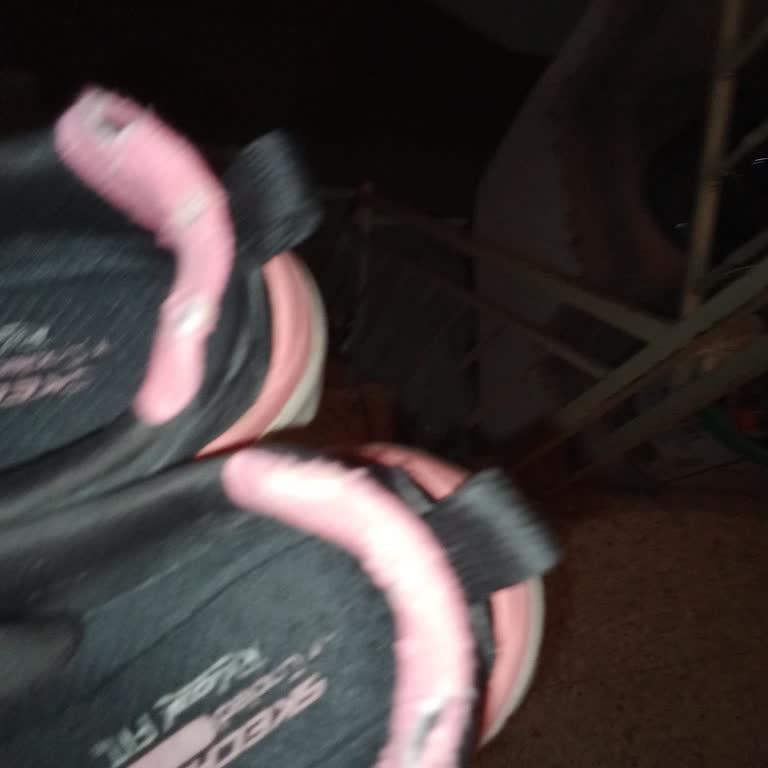 Skechers Ayakkabıda Haksız Kullanıcı Hatası İddiası Mağduriyeti