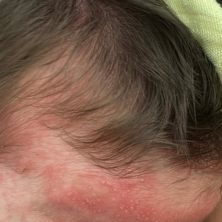 Bozuk Bebelac Mama Nedeniyle Bebeğimin Sağlığı Tehlikeye Girdi