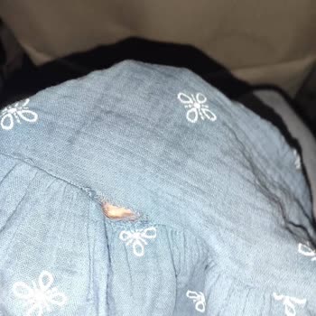 Aldığım Etek Kısa Sürede Açıldı, Müşteri Hizmetleri Duyarsız Kaldı