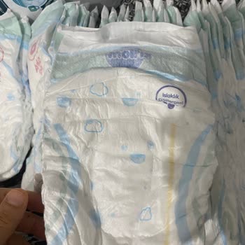 Ultra Molfix Ambalajında Klasik Bez Çıktı, Kalite Farkı Yaşadım