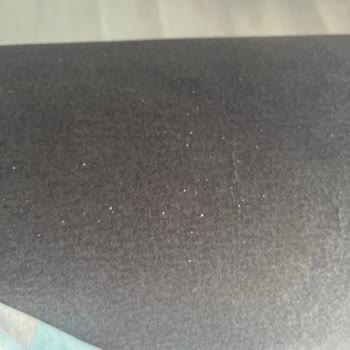 Head&Shoulders Şampuanında Artan Kaşıntı Ve Kepek Sorunu