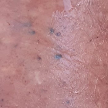 Torku Kasap Sucukta Siyah Oluşumlar Ve İlgisiz Müşteri Hizmetleri