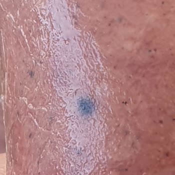 Torku Kasap Sucukta Siyah Oluşumlar Ve İlgisiz Müşteri Hizmetleri