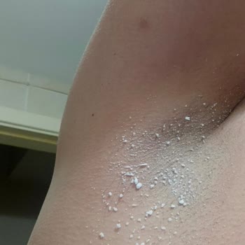 Nivea Deo Stick zieht nicht ein, 4× gekauft, alle klumpen auf der Haut!