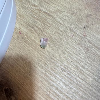 Çiğdem Köroğlu Beauty Tırnak Bakımı Sonrası Enfeksiyon Ve İlgisizlik