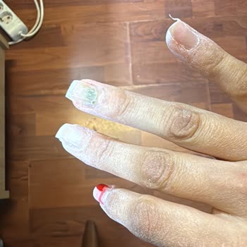 Çiğdem Köroğlu Beauty Tırnak Bakımı Sonrası Enfeksiyon Ve İlgisizlik