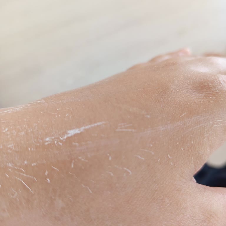 Bioderma Spot Güneş Kremi Cildimde Alerji Ve Pütürlü Tabaka Oluşturdu