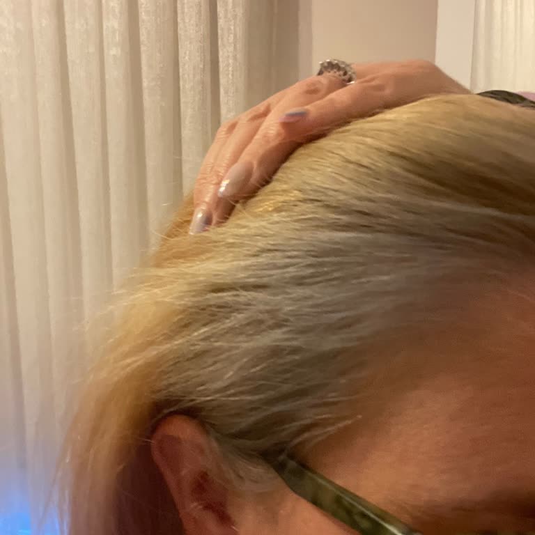 Garnier 10.1A Haarfarbe hat meine blonden Haare grau-grün gefärbt