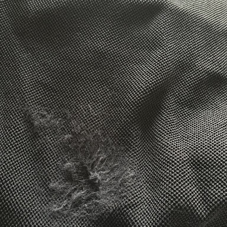 Beymen Club Elbise İlk Kullanımda Parçalandı, Müşteri Desteği Yetersiz