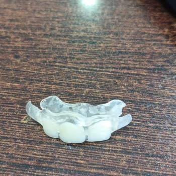 Geçici Diş Ücreti Ve Hizmette Yaşanan Hayal Kırıklığı