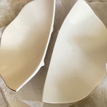 Kırık Ürün Ve Müşteri Temsilcisine Ulaşamama Sorunu