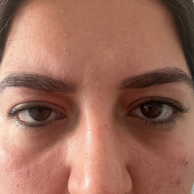 Sephora Size Up Rimel Gözlerimde Şişlik Ve Rahatsızlık Yaptı