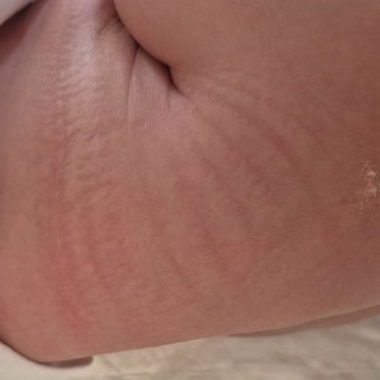 Aldığım Molfix Çocuk Bezi Hem Sıkı Hem De Sızıntı Yapıyor