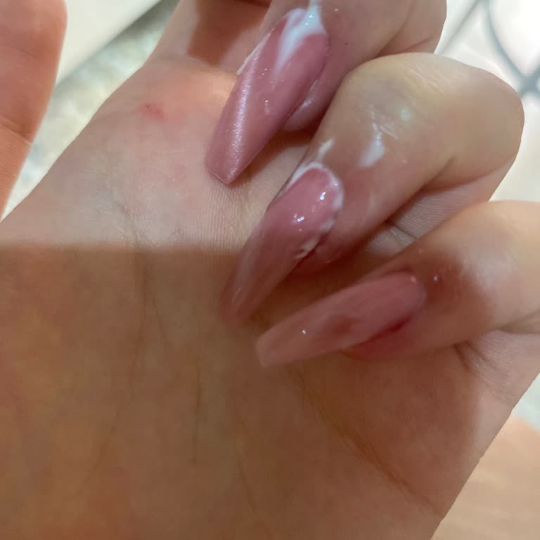 Hijyen Eksikliği Nedeniyle Tırnak Enfeksiyonu Ve Ağrı