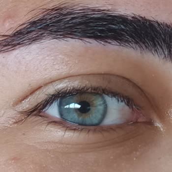 Kirpik Lifting İşlemi Sonuçsuz Ve Param Boşa Gitti