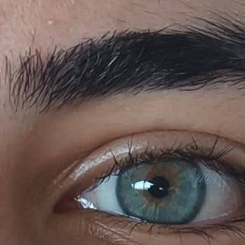 Kirpik Lifting İşlemi Sonuçsuz Ve Param Boşa Gitti