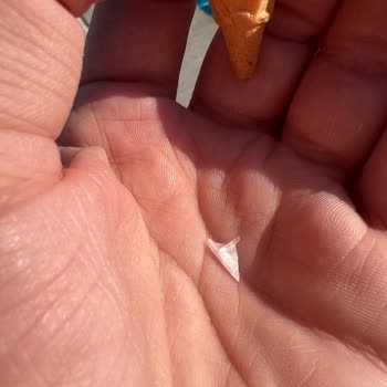 Otelin Sağlık İhmali Ve İlgisizliği Tatilimi Kabusa Çevirdi