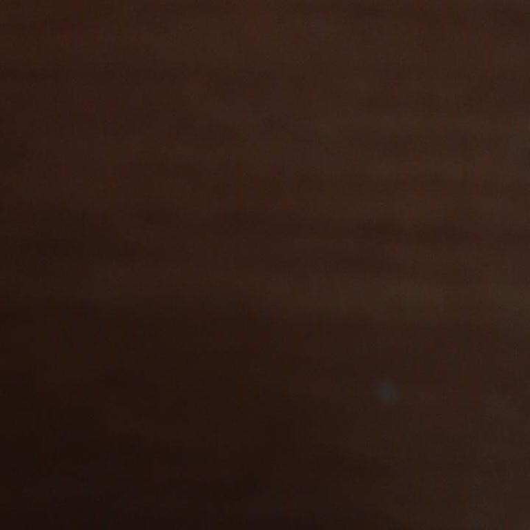 Kasko Sonrası İlgisizlik Ve Yetersiz Çekici Hizmeti