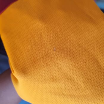 Etiketli Ürüne Leke İtirazıma Ret Ve Haksız Muamele