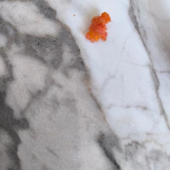 Namet Sucukta Yabancı Madde Şüphesi