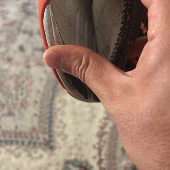 Skechers 14 Günde Kullanılamaz Hale Gelen Ayakkabı Ve Mağaza İlgisizliği