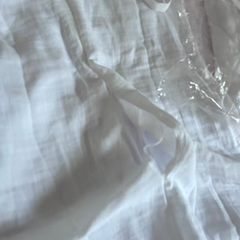 Hasarlı Ve Lekeli Ürün Teslimatı, Yetersiz Müşteri Desteği