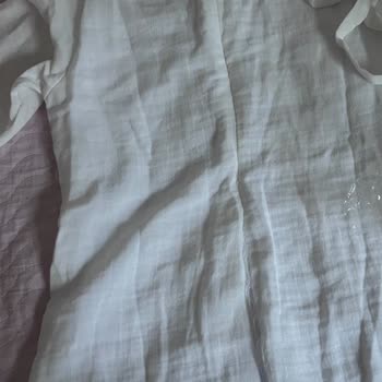 Hasarlı Ve Lekeli Ürün Teslimatı, Yetersiz Müşteri Desteği